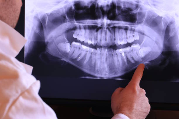 Best Walk-In Emergency Dental Services in Manito, IL