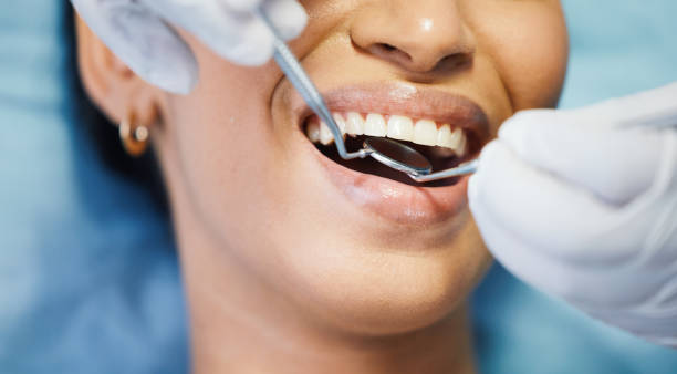 Best Broken or Chipped Tooth Repair in Manito, IL
